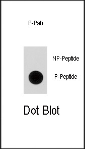 Phospho-p21 (Ser130) Antibody in Dot Blot (DB)