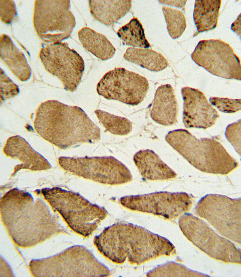 Phospho-p27 Kip1 (Ser10) Antibody in Immunohistochemistry (Paraffin) (IHC (P))