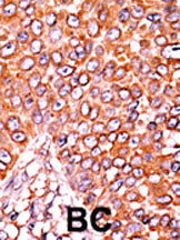 Phospho-p27 Kip1 (Thr157) Antibody in Immunohistochemistry (Paraffin) (IHC (P))