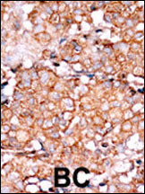 Phospho-RAD9 (Ser328) Antibody in Immunohistochemistry (Paraffin) (IHC (P))
