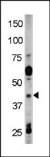 Phospho-RAD9 (Tyr28) Antibody in Western Blot (WB)