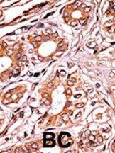 Phospho-Rb (Ser249) Antibody in Immunohistochemistry (Paraffin) (IHC (P))