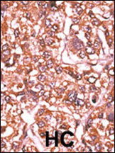 Phospho-Rb (Ser612) Antibody in Immunohistochemistry (Paraffin) (IHC (P))