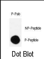Phospho-Crk (Ser41) Antibody in Dot Blot (DB)