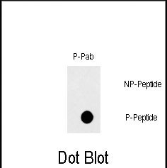 Phospho-FAS (Tyr291) Antibody in Dot Blot (DB)