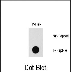 Phospho-PAK1 (Thr212) Antibody in Dot Blot (DB)