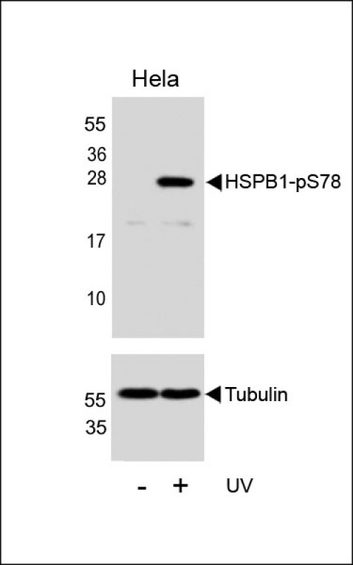 Phospho-HSP27 (Ser78) Antibody in Western Blot (WB)