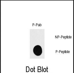 Phospho-p70 S6 Kinase (Ser418) Antibody in Dot Blot (DB)