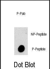 Phospho-VPS34 (Ser282) Antibody in Dot Blot (DB)