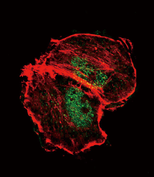 Phospho-TSC2 (Ser664) Antibody in Immunocytochemistry (ICC/IF)