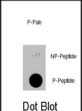 Phospho-PDPK1 (Ser396) Antibody in Dot Blot (DB)
