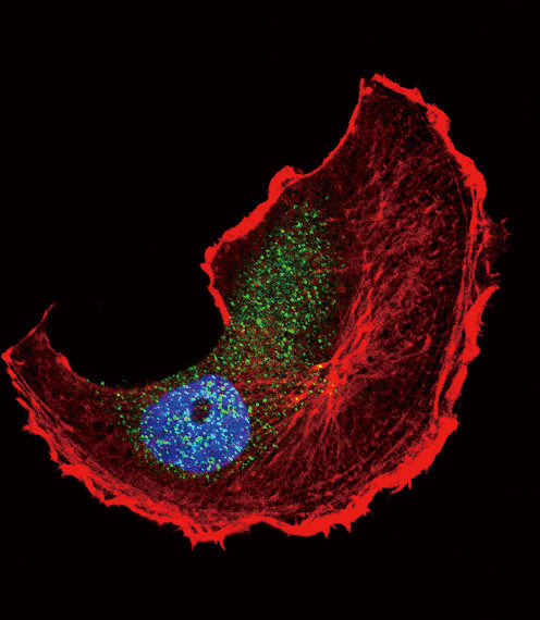 Phospho-TSC2 (Ser1798) Antibody in Immunocytochemistry (ICC/IF)