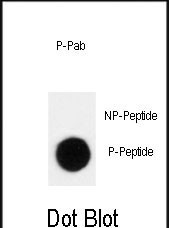 Phospho-p27 Kip1 (Thr198) Antibody in Dot Blot (DB)