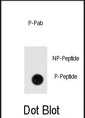 Phospho-TEM8 (Tyr382) Antibody in Dot Blot (DB)