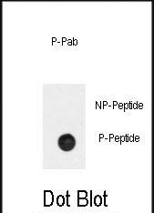 Phospho-beta-2 Adrenergic Receptor (Ser261) Antibody in Dot Blot (DB)