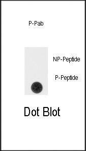 Phospho-SPRY4 (Tyr75) Antibody in Dot Blot (DB)