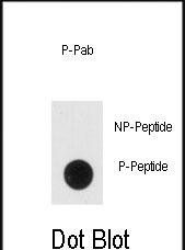 Phospho-NSE (Tyr236) Antibody in Dot Blot (DB)