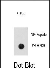 Phospho-CDK2 (Thr14) Antibody in Dot Blot (DB)