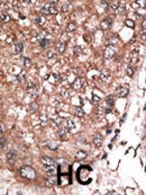 HAND2 Antibody in Immunohistochemistry (Paraffin) (IHC (P))
