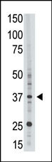 EPR1 Antibody in Western Blot (WB)