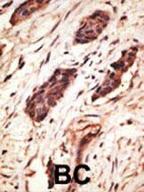 MMP10 Antibody in Immunohistochemistry (Paraffin) (IHC (P))