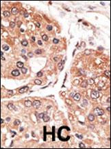 SMYD5 Antibody in Immunohistochemistry (Paraffin) (IHC (P))