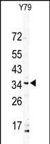 DSCR3 Antibody in Western Blot (WB)