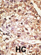 alpha Synuclein Antibody in Immunohistochemistry (Paraffin) (IHC (P))