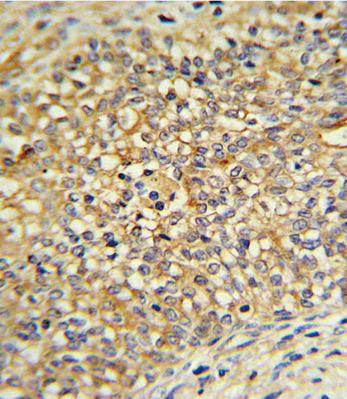UGT2B17 Antibody in Immunohistochemistry (Paraffin) (IHC (P))