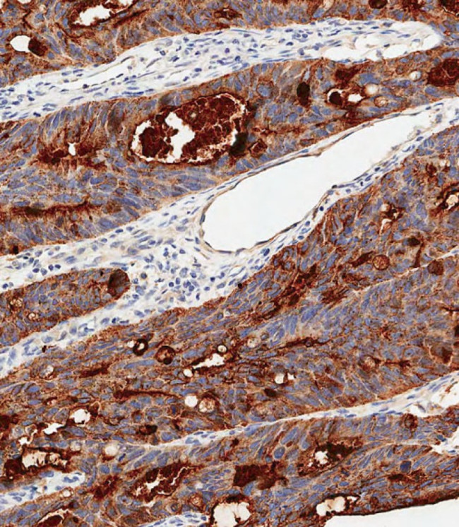 CEA Antibody in Immunohistochemistry (Paraffin) (IHC (P))