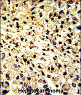 DCL-1 Antibody in Immunohistochemistry (Paraffin) (IHC (P))