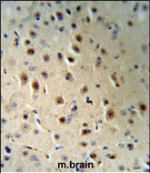 AGO1 Antibody in Immunohistochemistry (Paraffin) (IHC (P))
