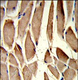 RRM2 Antibody in Immunohistochemistry (Paraffin) (IHC (P))