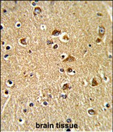 PDIA6 Antibody in Immunohistochemistry (Paraffin) (IHC (P))