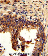 Cytokeratin 4 Antibody in Immunohistochemistry (Paraffin) (IHC (P))