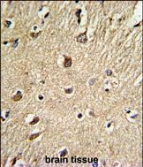 Biglycan Antibody in Immunohistochemistry (Paraffin) (IHC (P))