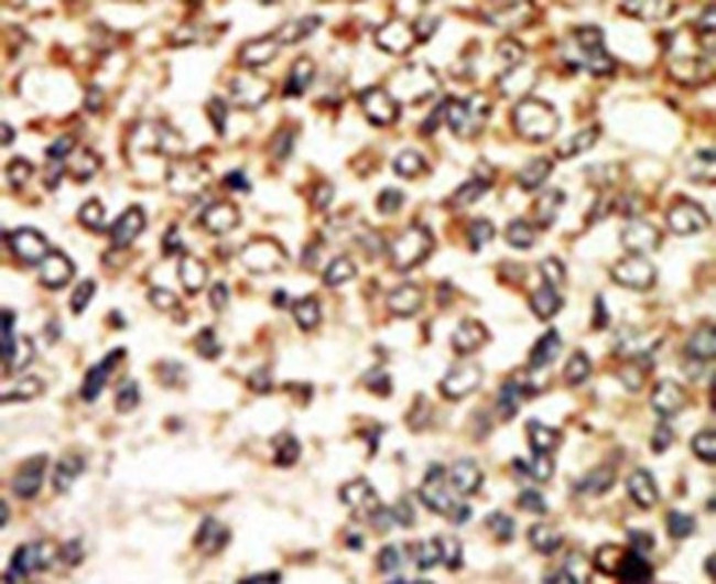PKA alpha/beta Antibody in Immunohistochemistry (Paraffin) (IHC (P))