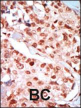 AMPK gamma-1 Antibody in Immunohistochemistry (Paraffin) (IHC (P))