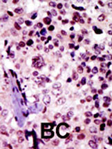 PRKAR1B Antibody in Immunohistochemistry (Paraffin) (IHC (P))