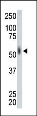 MKNK2 Antibody in Western Blot (WB)