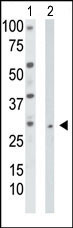 TK2 Antibody in Western Blot (WB)