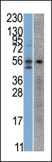 STK38 Antibody in Western Blot (WB)