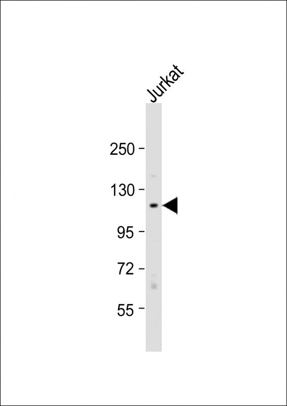 TAOK1 Antibody in Western Blot (WB)