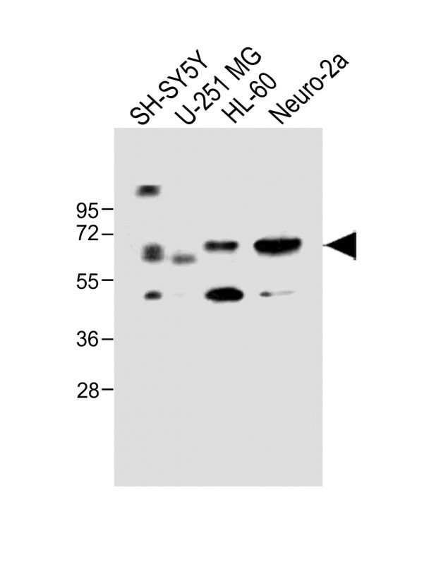 CERK Antibody in Western Blot (WB)