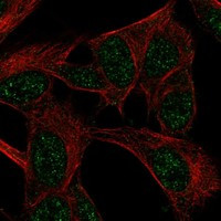 FANCF Antibody in Immunocytochemistry (ICC/IF)