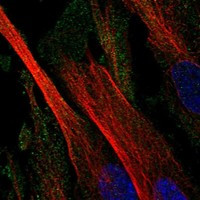 CD109 Antibody in Immunocytochemistry (ICC/IF)
