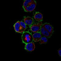 CD30 Antibody in Immunocytochemistry (ICC/IF)