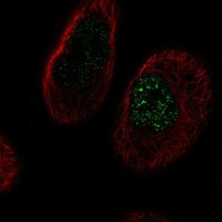 TMEM45B Antibody in Immunocytochemistry (ICC/IF)