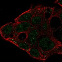 PUNC Antibody in Immunocytochemistry (ICC/IF)