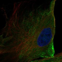 TMEM16K Antibody in Immunocytochemistry (ICC/IF)